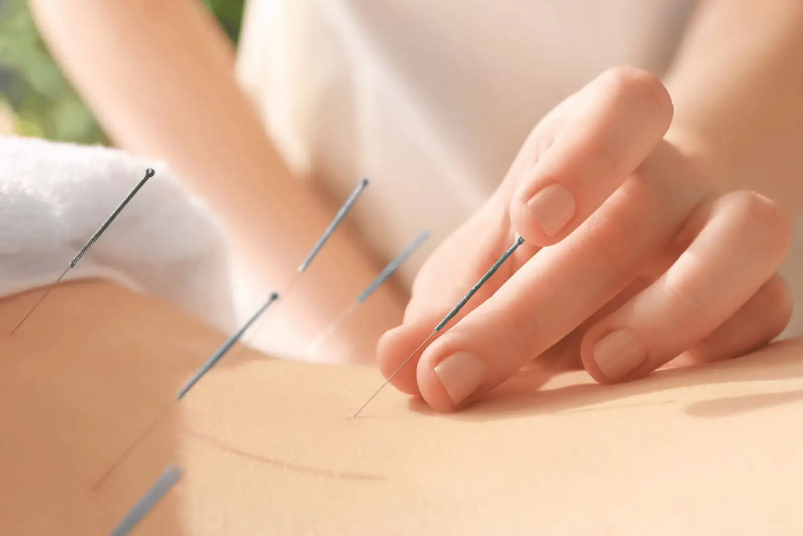 Traditional Chinese Medicine & Acupuncture